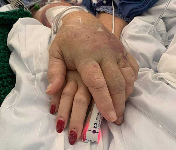 patient story holding hands