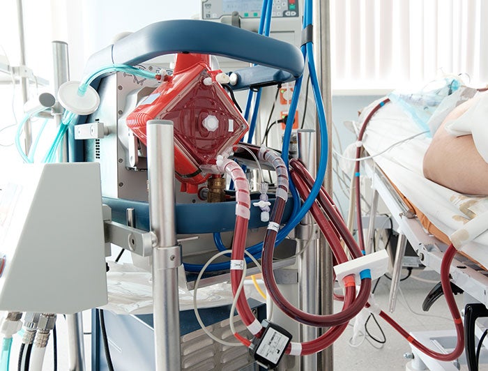 Patient lying down in hospital bed, connected to a extracorporeal membrane oxygenation machine