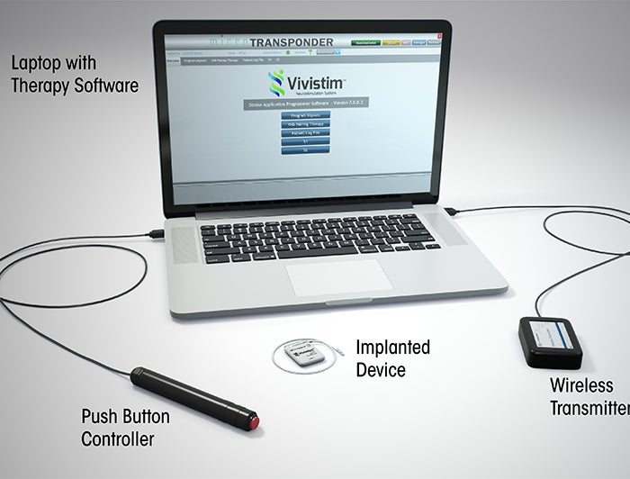 Vivistim system components: implant, wireless transmitter, controller, and laptop with software interface displayed