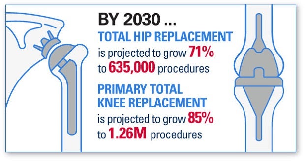 AHA Market Scan 5 Ways AI is Improving Care Delivery Infographic. By 2030, totoal hip replacement is projected to grow 71% to 635,000 procedures. Primary total knee replacement is projected to grow 85% to 1.26 million procedures.