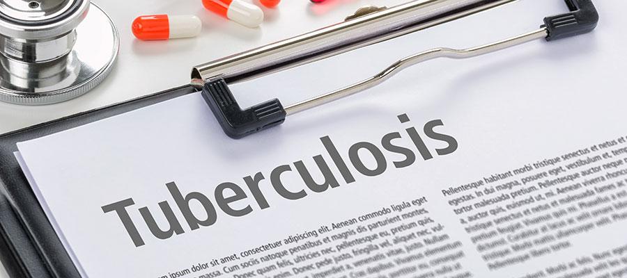 Tuberculosis 